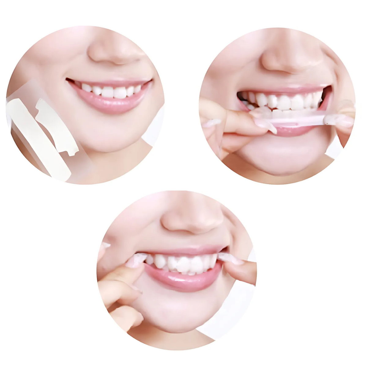Smilumin – Teeth Care Kit with LED Light and Strips